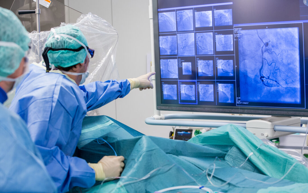 Surgeons in blue scrubs and masks monitor angiography images on a large screen during a procedure